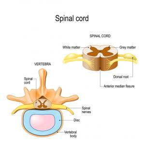 What is Spinal Cord Syndrome and how does it relate to pain from an accident